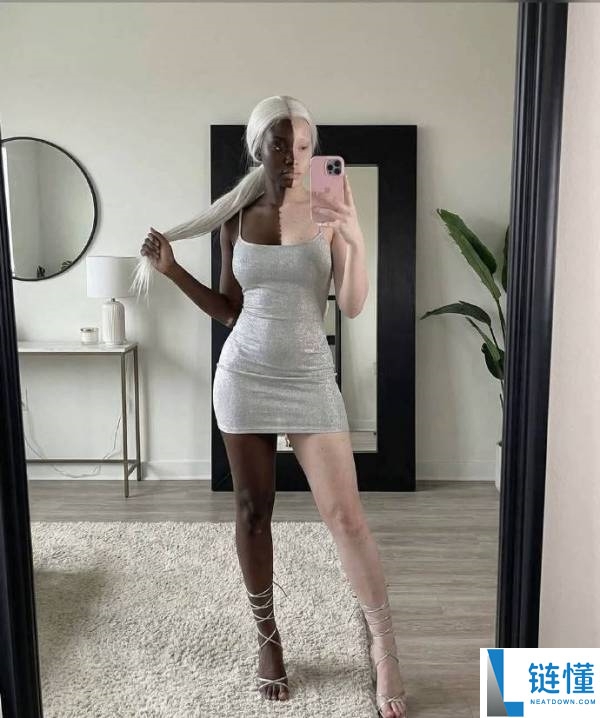 一个得了白癜风的美国女孩火了 网友:还真能这么平均