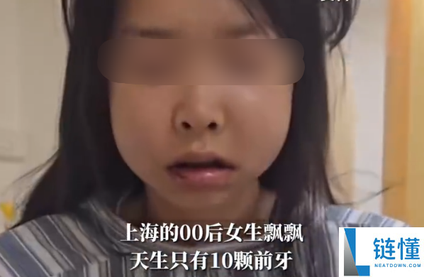 00后男子天生只要10颗前牙：提示人人珍惜牙齿