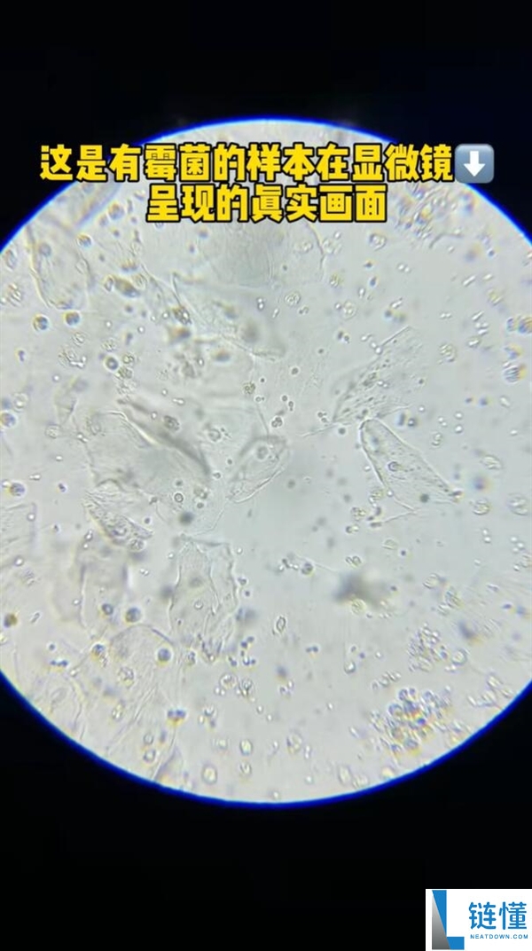 霉菌这类致癌物藏在家里:良多人浑然不知