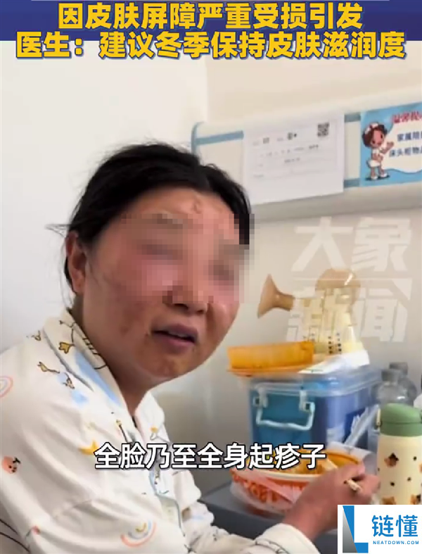 怕孩子被传染流感：新手宝妈频繁洗手致过敏、脸变形