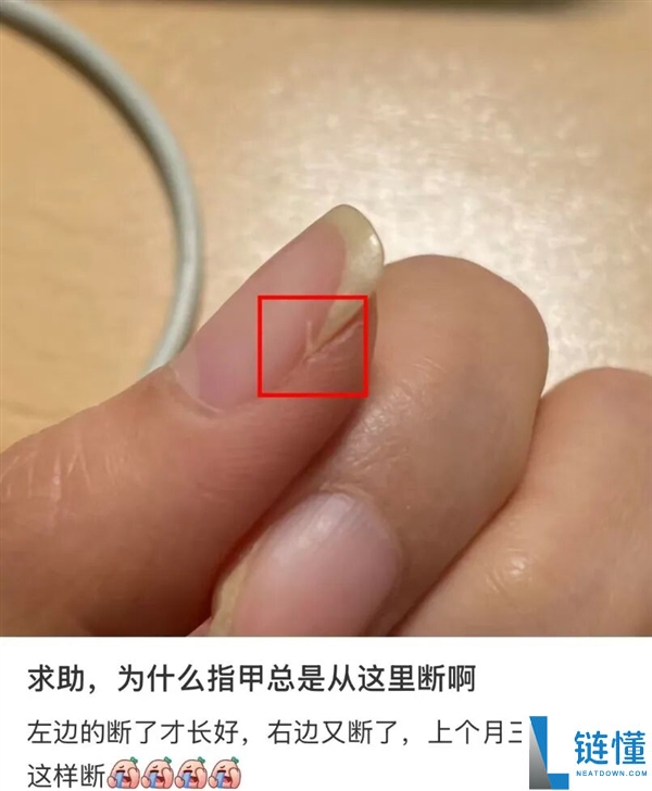 指甲为什么总从这个处所断开 是缺钙了吗