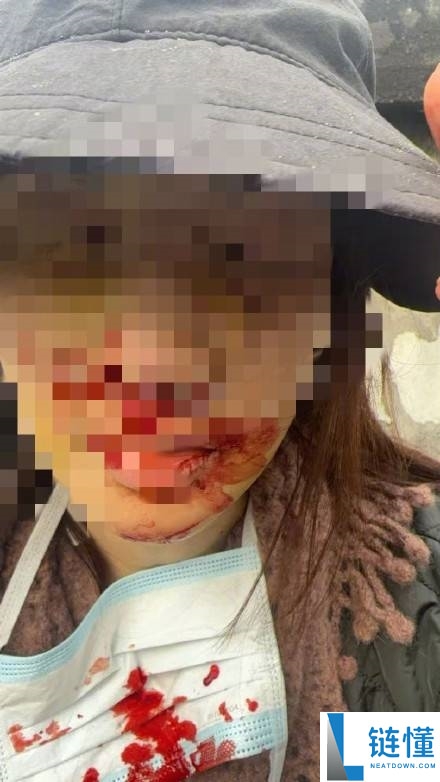 金晨车祸事务始末,一分钟带你吃清楚这个瓜