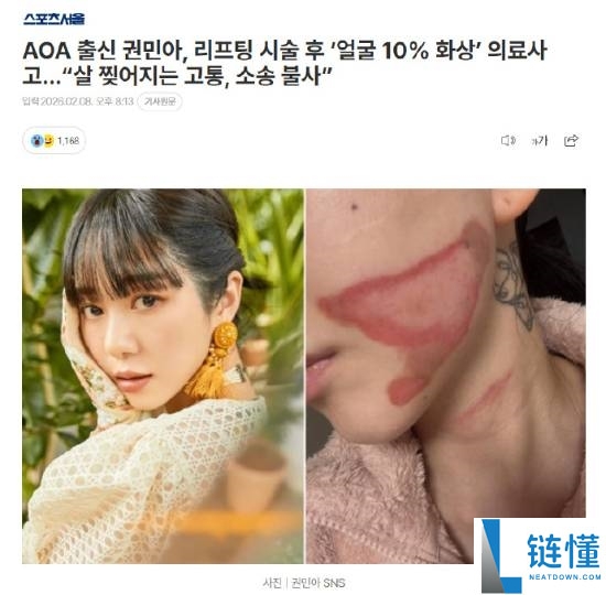 烧的太惨烈,韩国女星做医美居然致使面度灼伤