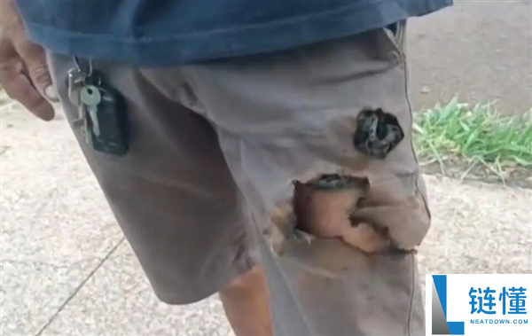 巴西男人被两条狗狂咬 手机倏忽爆炸救了他一命
