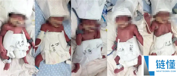 新疆24岁男子成功诞下1男4女5胞胎引全网祝愿：可谓生命的极致事业