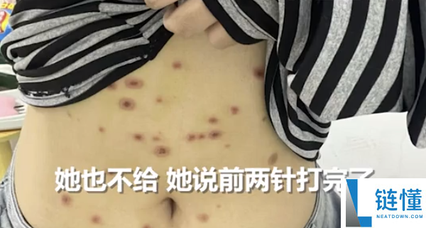 女生800元买猫被传染全身长猫藓 医治破费已近千元