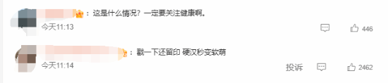 “吴京水肿”登热搜：脸上一按一个坑