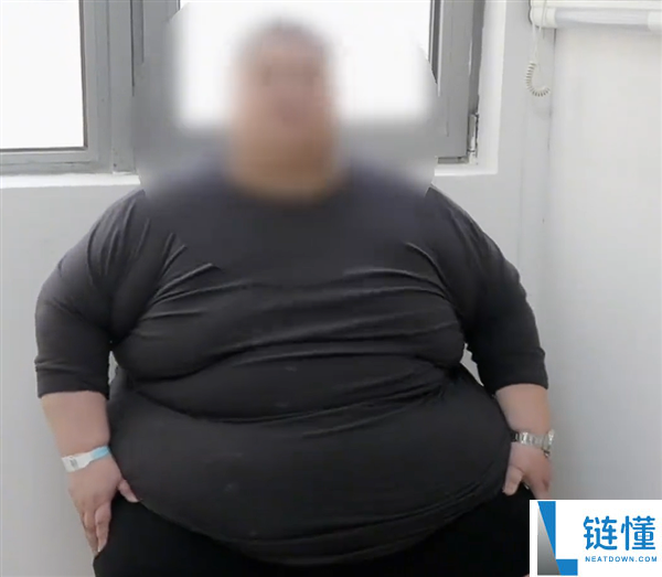 运发动退役后从146斤暴涨至523斤 手术切除75%胃组织