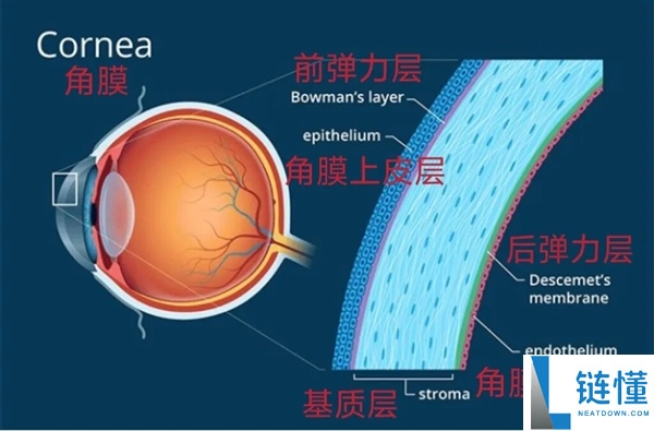 那些做了近视激光手术的人 后来怎样样了？