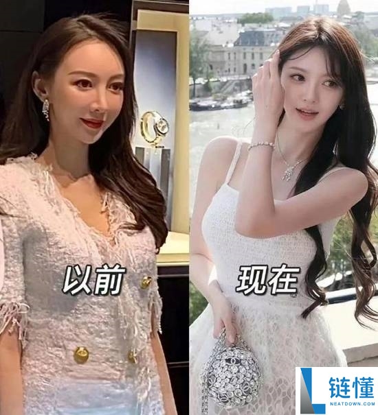 叶珂自曝全身医美：嫩肤 + 微调全解析，揭秘“全身 do 了”真相
