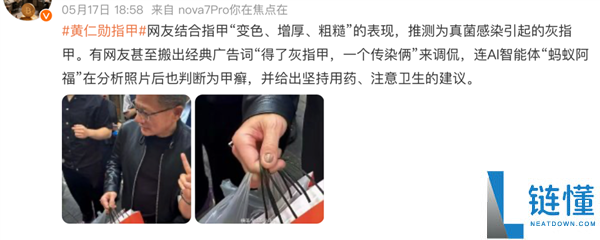 黄仁勋指甲被疑灰指甲？网友云诊断引热议，医生权威回应来了