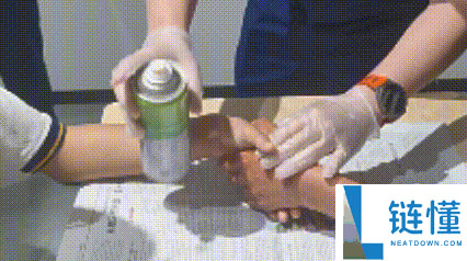 两男生手被 502 胶水粘住 2 小时，医生束手无策！119 紧急救援成功