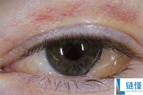 避免这4个“毁眼”行为，保护视力的关键方法