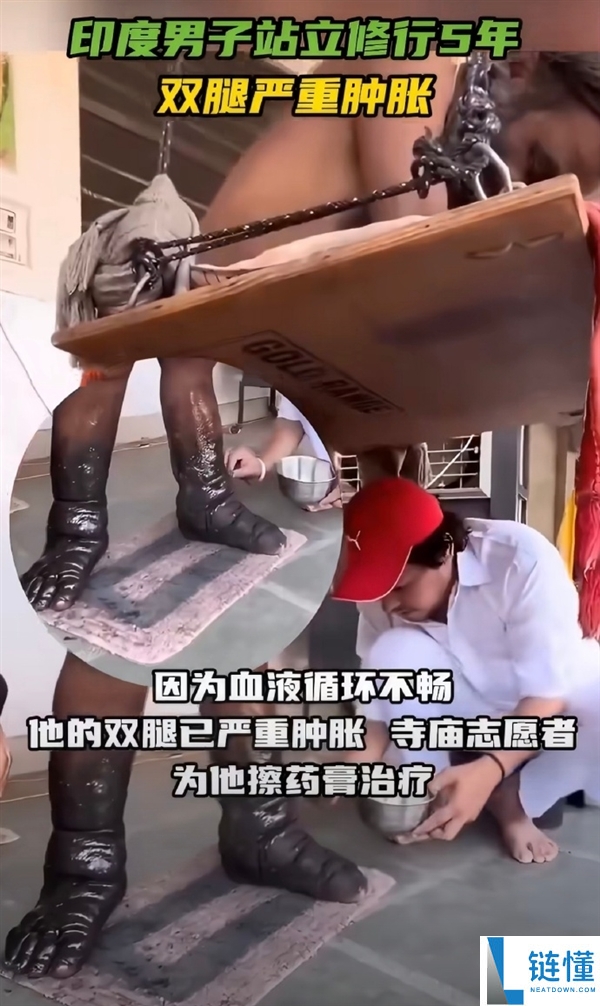 印度苦行僧坚持五年不坐不躺，双腿严重肿胀发黑，仍需再忍耐七年