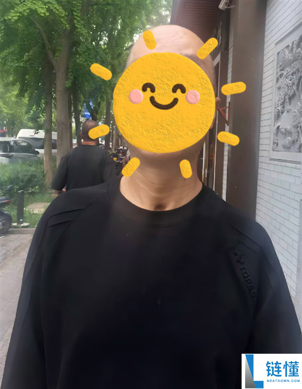 男子骑电摩不戴头盔与汽车碰撞，颅骨碎成17块的悲剧