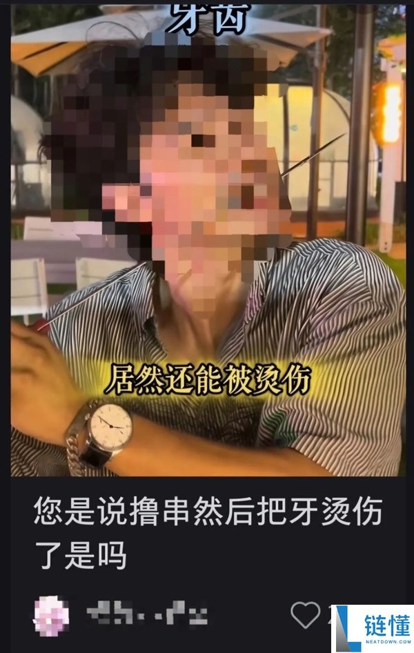 吃烤串烫伤牙齿的真实案例与预防方法